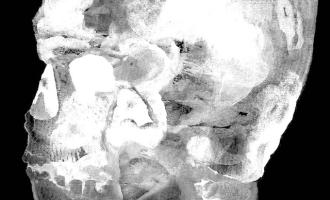 9b5520a4aafeaeb1caefa60195e7a5e5d6c244a2.jpeg